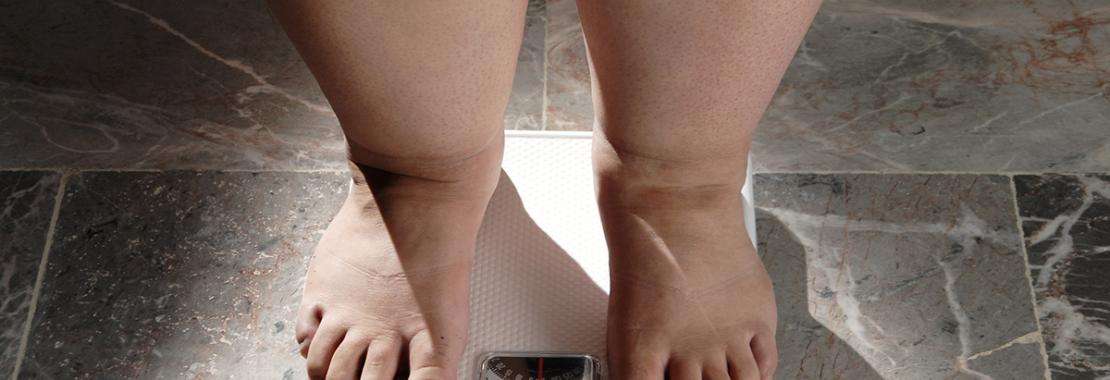 Andare oltre il Bmi per ridefinire l’obesità