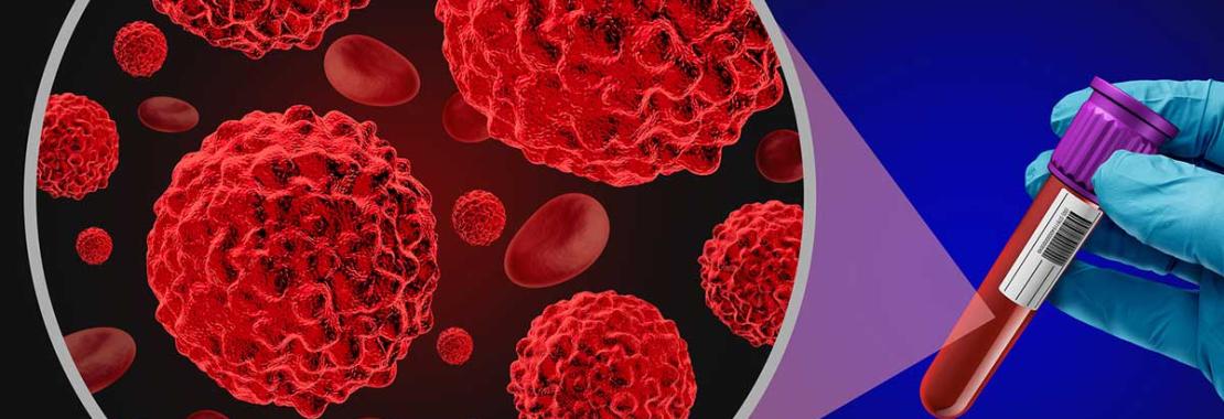 Multi-platform integration for the management of adrenal tumors