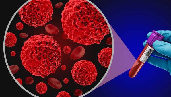 Multi-platform integration for the management of adrenal tumors