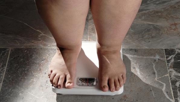 Obesità: la pandemia silenziosa che minaccia il Sistema Sanitario Nazionale